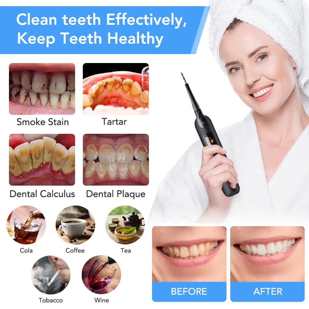Smart Electric Tooth Cleaner for Home Use